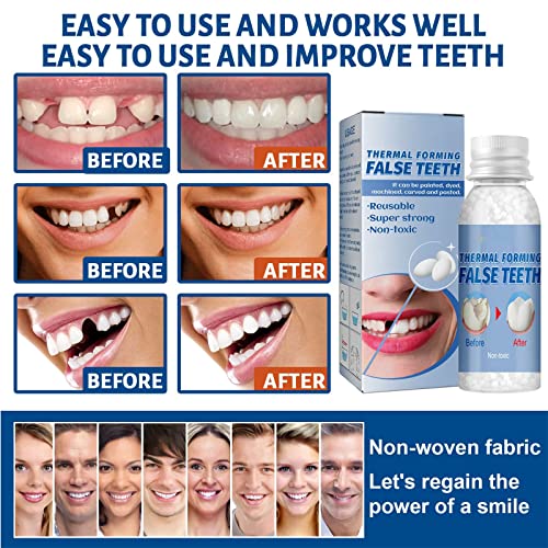 Пелети за ремонт на зъбите, Комплект за Ремонт на зъбите, Formable Изкуствени зъби, Термосвиваеми Топки за пломбирования, които Определят Липсващи и Счупени Зъбни лепило (10 мл)