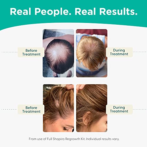 Климатик от косопад | Веганская формула на ДХТ за борба с изтъняване на косата, разработена от дерматолози | Направи косата по-здрави, буйни и гъсти - alya serif MD | Запас на 1 месец